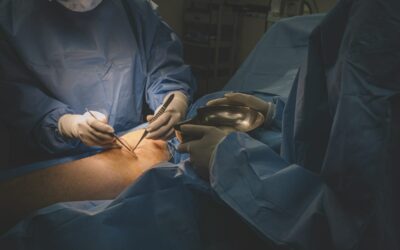 Jakie są efekty osteotomii w poprawie jakości życia pacjentów?