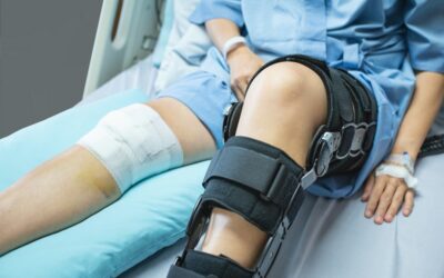 Operacja kolana – jak przygotować się finansowo?