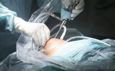 Jakie są najnowsze osiągnięcia w dziedzinie artroskopii i ich wpływ na cenę?