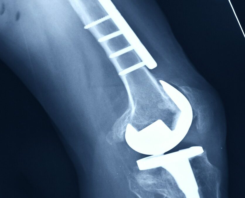 Jakie są różnice w występowaniu powikłań po różnych typach osteotomii?